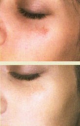 before_after_pictures.jpg